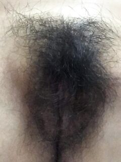 Chọn